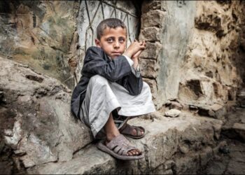 400 ألف طفل يمني يواجه الموت