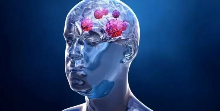 دواء يُعالج الصحة العقلية وسرطان الدماغ