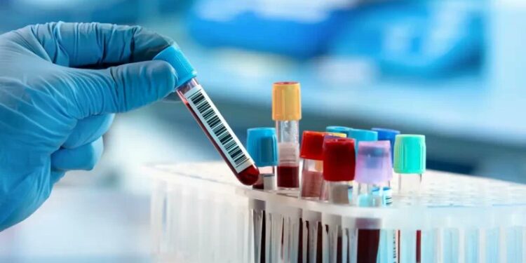 علماء يطورون صبغات فلورية لتشخيص الأمراض بدقة عالية